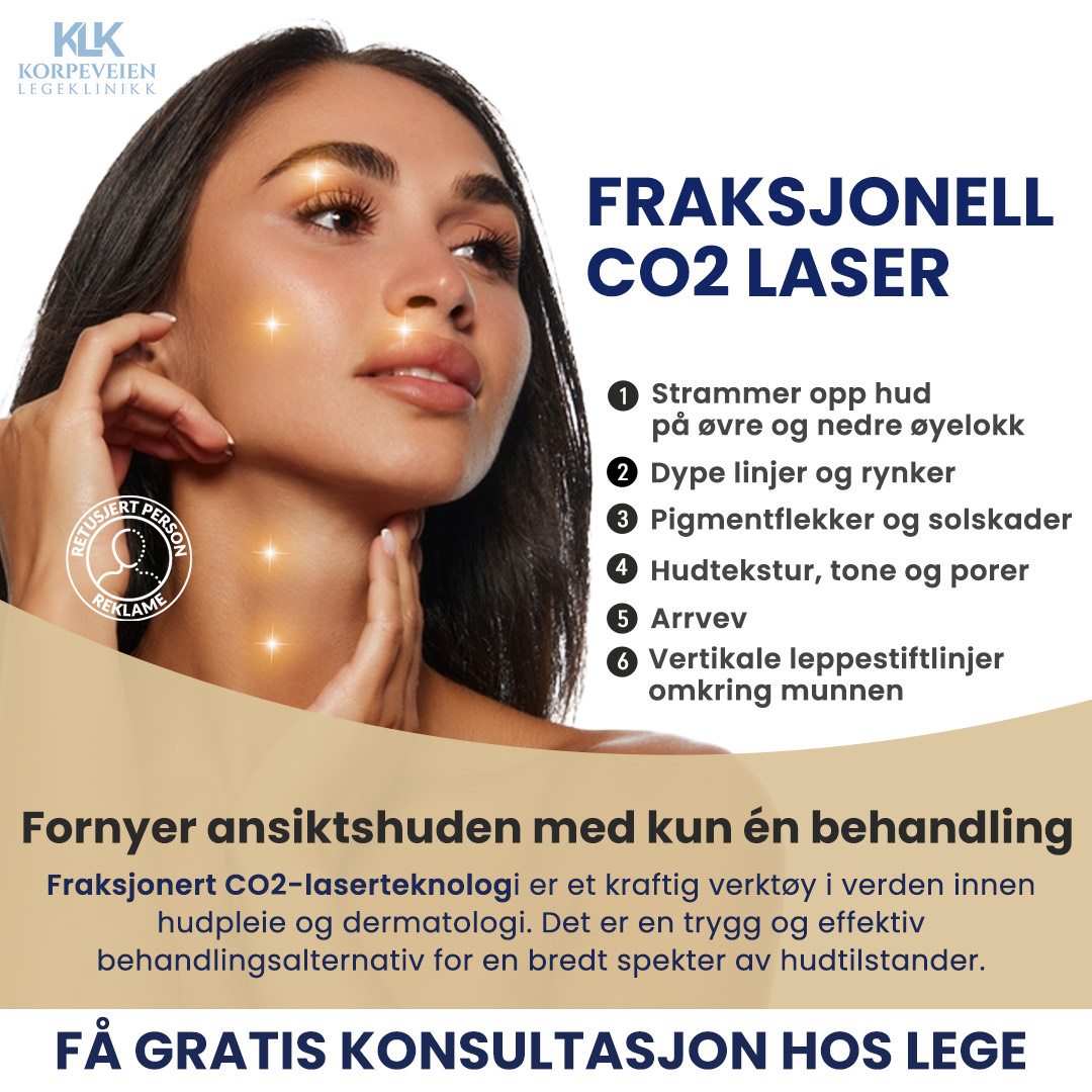 CO2 laser fordeler - strammer hud, fjerner rynker og pigmentflekker